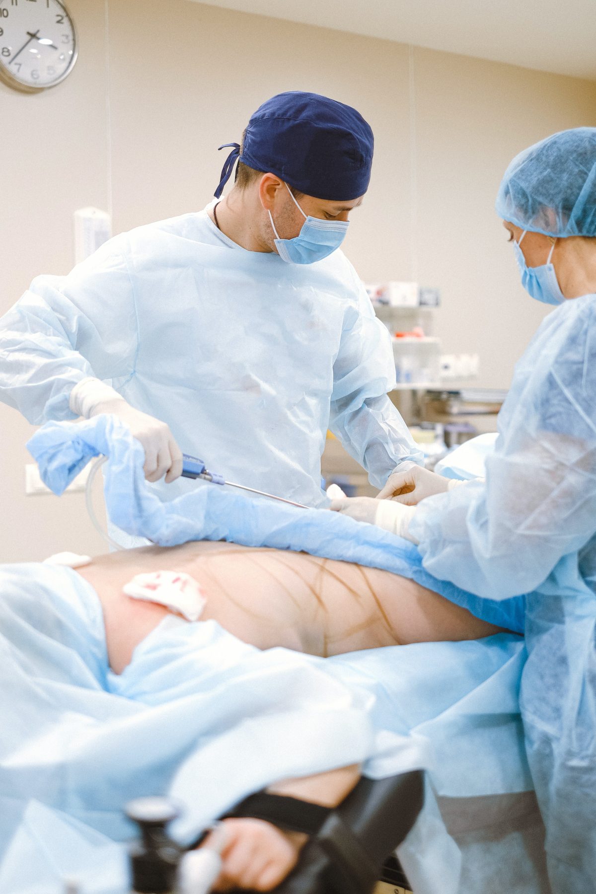 Aspectos Importantes de las Abdominoplastias: Lo que debes saber antes de someterte a este procedimiento